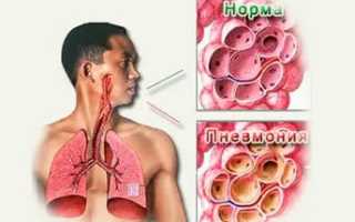 Почему у ребенка кашель и тяжелое дыхание, способы лечения
