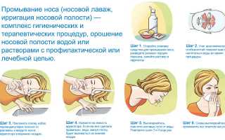 Как промыть ребенку нос перекисью водорода