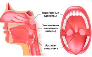 Хлорофиллипт при аденоидах у детей